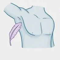 Axillary Hyperhidrosis - Armpits